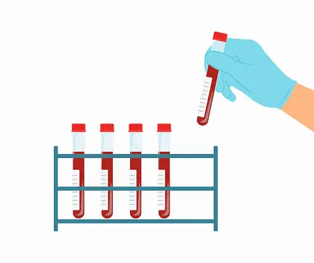 Hand In Medical Gloves Holding Blood Test Tube. Close-up Of Blood Test Tubes On Rack. Medical Blood Test and Blood Analysis